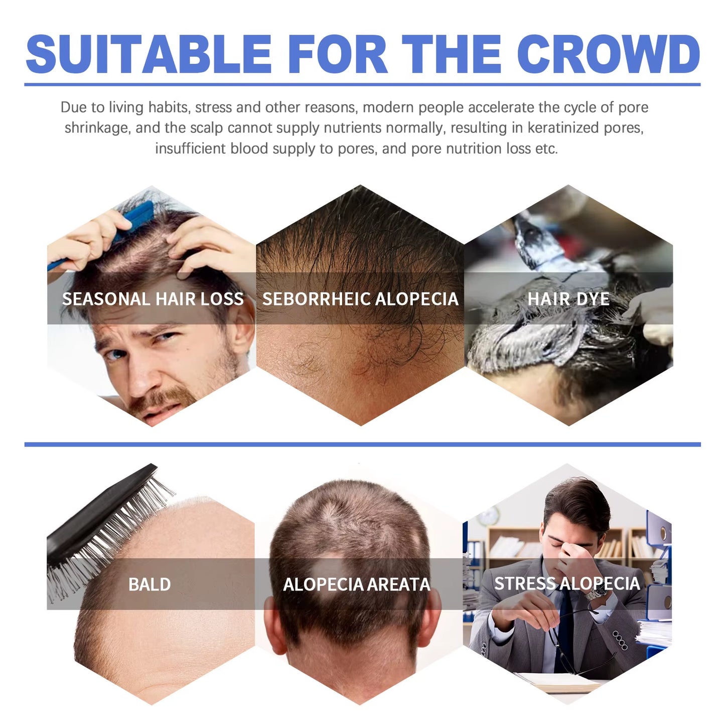 Hair Growth Foam Thinning Scalp Treatment Hereditary Seborrheic Hair Loss Regrowth Thicken Repairing Hair Follicles Care Product