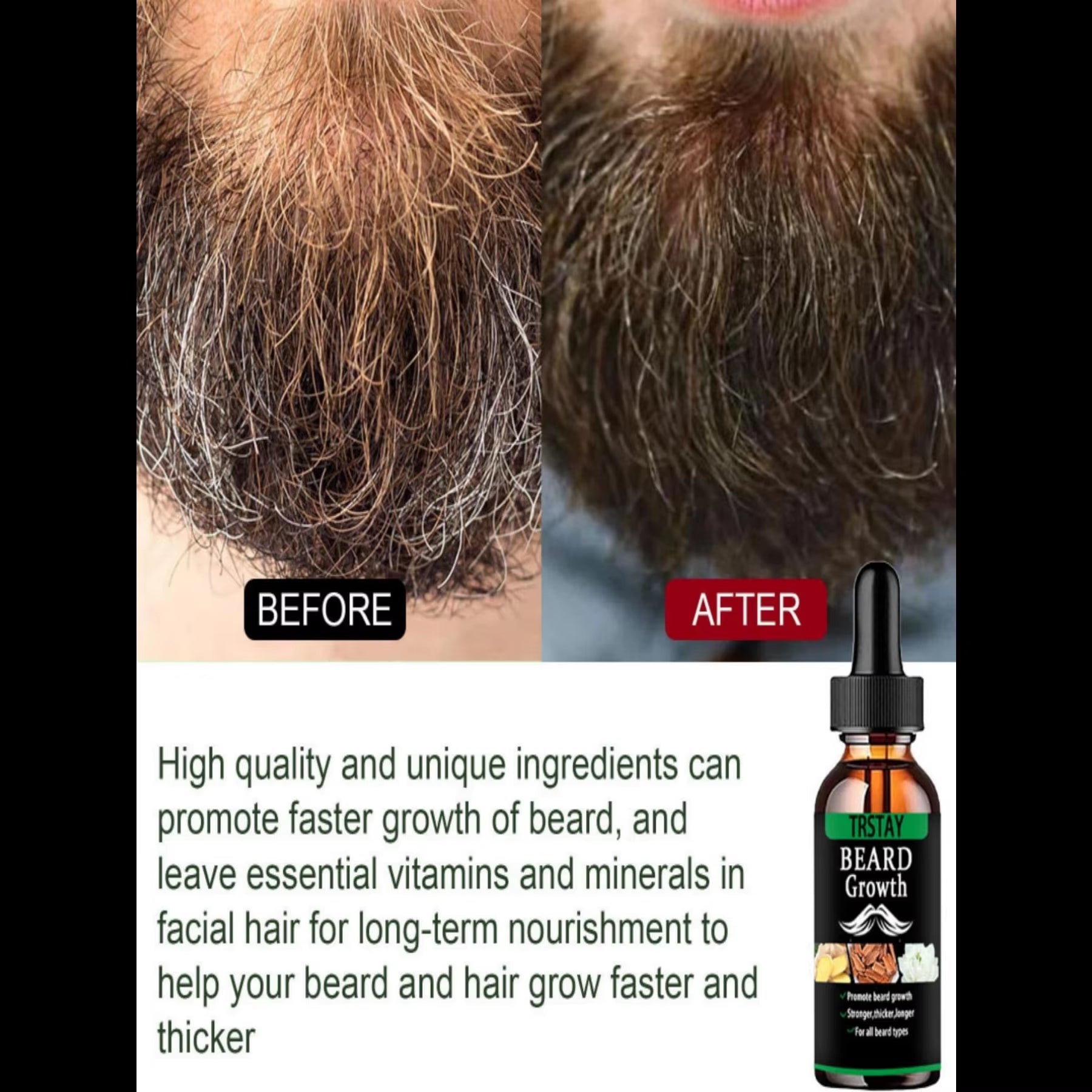 NEW Beard Hair Growth Essential Oil anti Hair Loss Product Natural Mustache Regrowth Oil for Men Nourishing Beard Care Roller