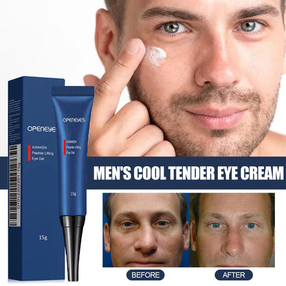 Men Retinol Eye Bags Remover Cream anti Dark Circles anti Puffiness Fade Fine Line Lifting Firming Moisturizing Repair Skin Care